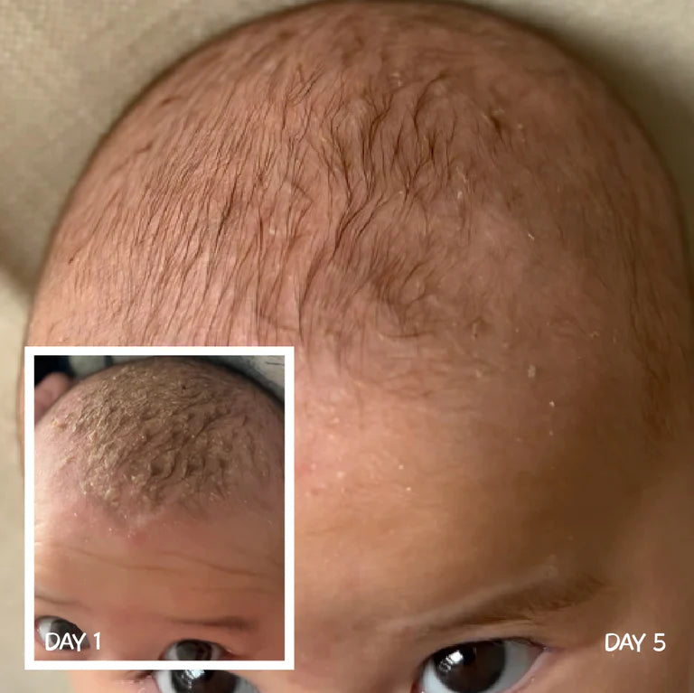 MooGoo Baby Scalp Repair Cream 120g