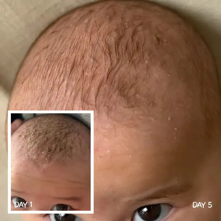 MooGoo Baby Scalp Repair Cream 120g